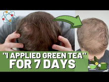 Load and play video in Gallery viewer, Regrow Hair From Pure Health Research